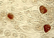 Chlamydia trachomatis, Einschlusskörperchen