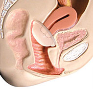 Diaphragma Standort