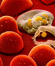 Detail-Foto des HIV-2-Erregers