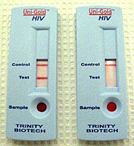 HIV-Suchtest bzw. Schnelltest