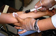 HIV-Test