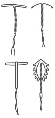 Intrauterinpessare, verschiedene  Varianten Formen