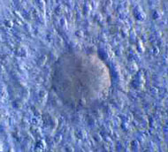 Die Eizelle mit ihrem Kranz von Nährzellen (Cumulus)
