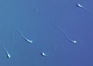 Die Samenzellen