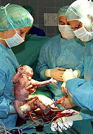 Kaiserschnitt Operation