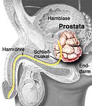 Die Prostata ist das Sexualorgan des Mannes.