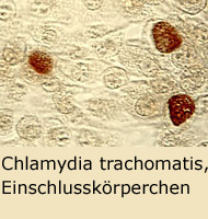 Chlamydia trachomatis, Einschlusskörperchen