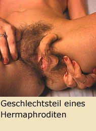 Geschlechtsteil eines Hermaphroditen