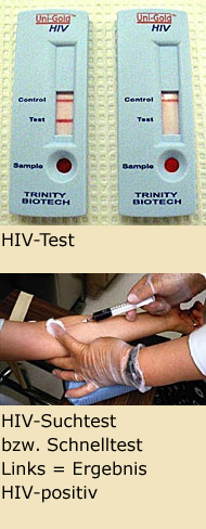 HIV-Test