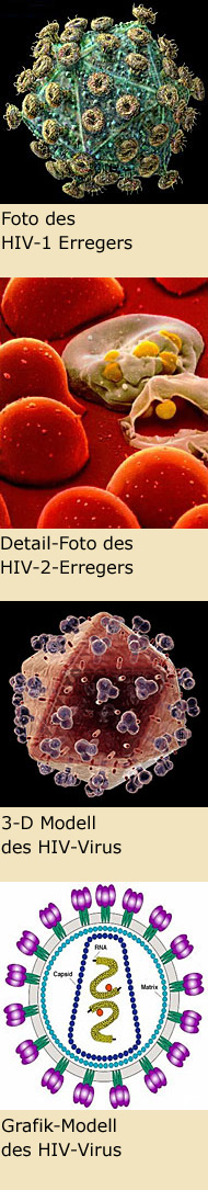 Foto des HIV-Erregers