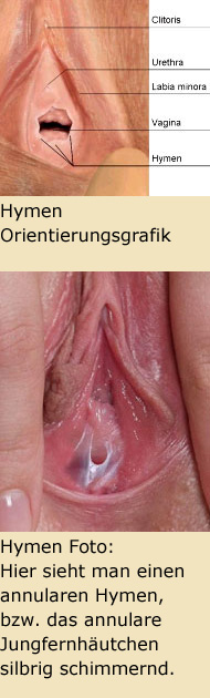 Hymen Orientierungsgrafik